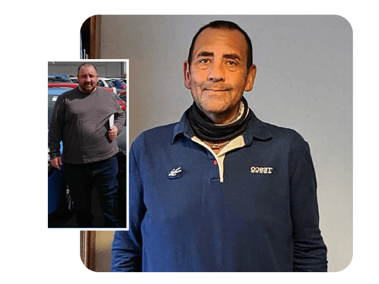 Image of success story Simon before and after gastric sleeve surgery