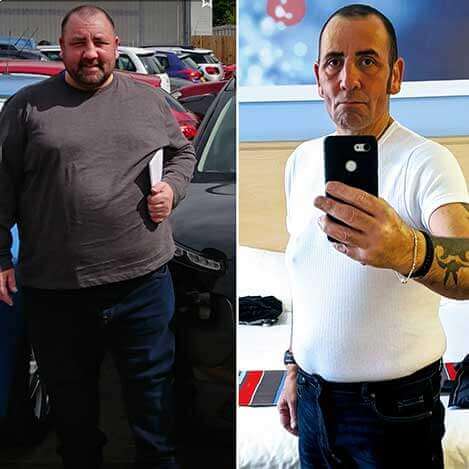 Simon-before-and-after-having-gastric-sleeve-surgery-in-2019
