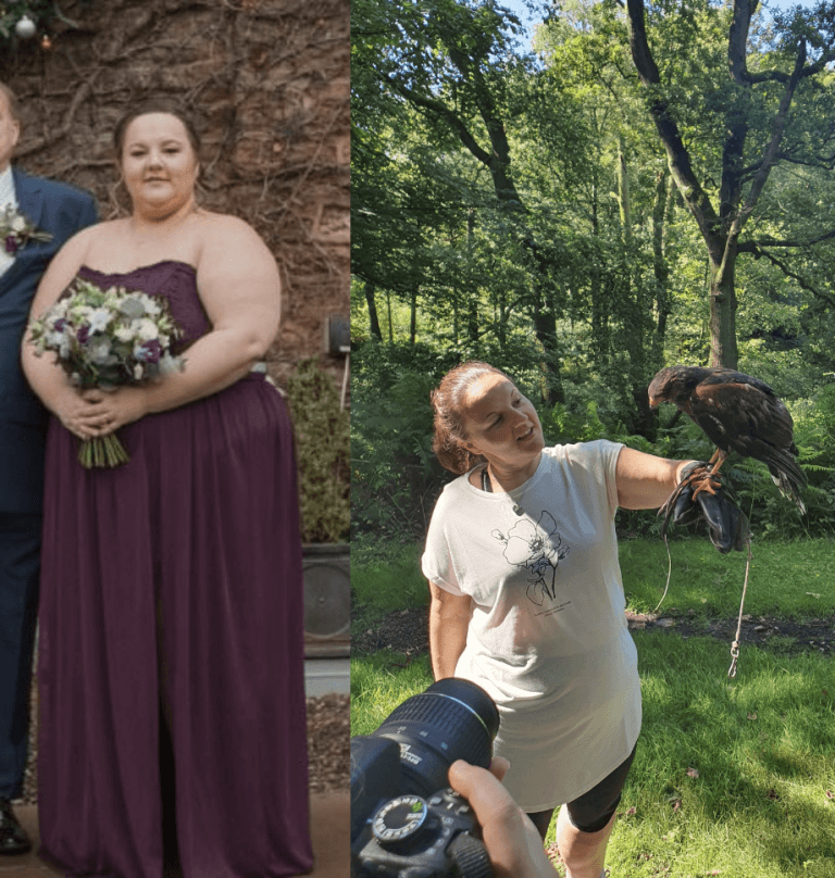 Sam - Gastric Sleeve - Before and After